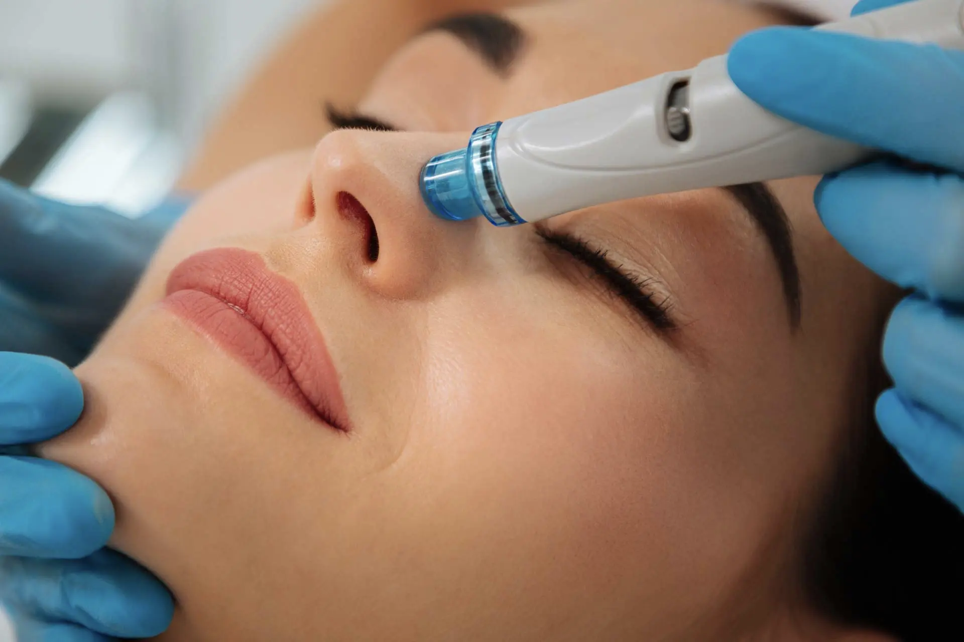 Micro Hydra Facial | Rupi Beauty Studio